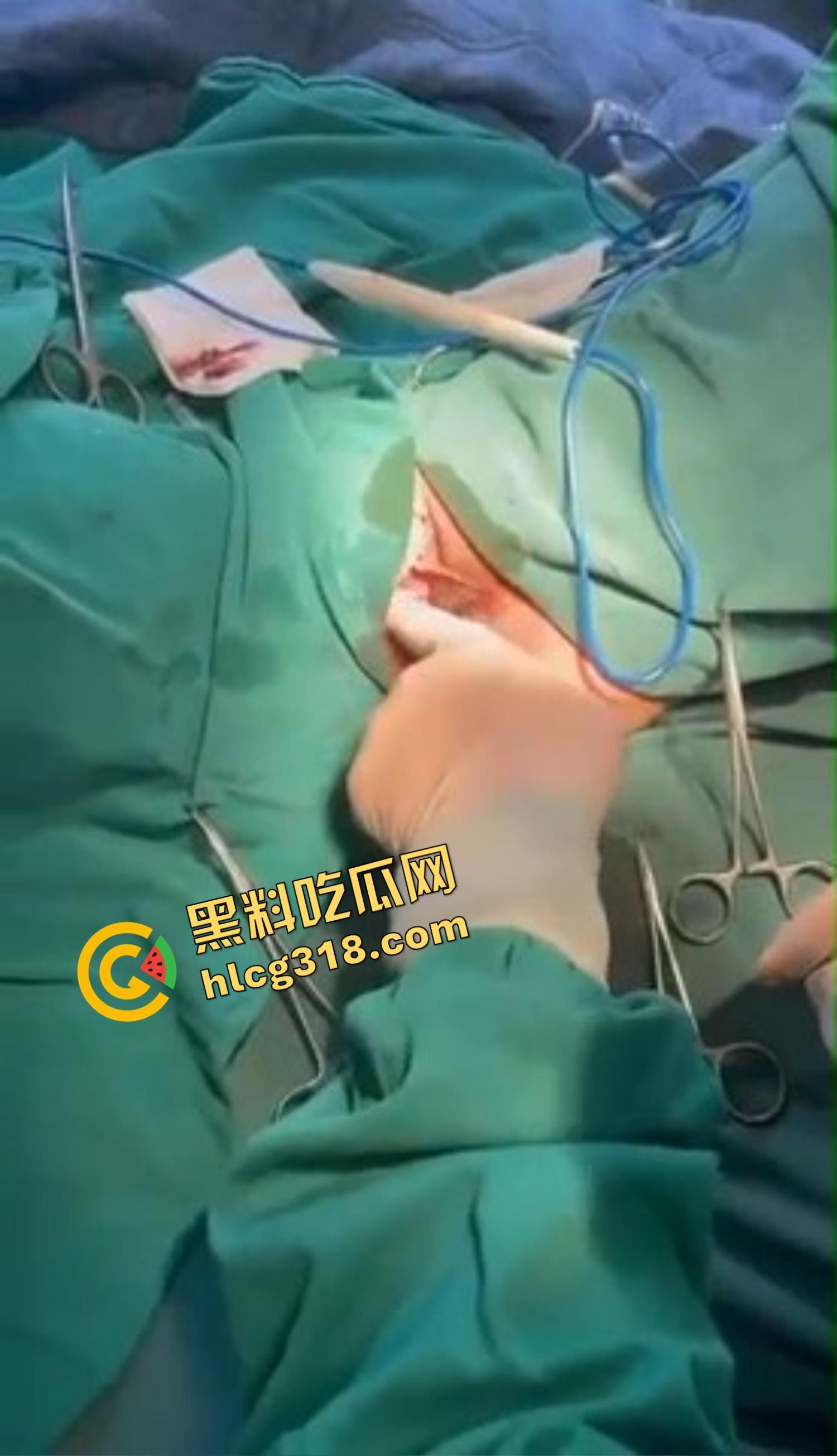 你还以为高端外围豪车天生紧?全靠阴道收缩术收成死夹货,富哥上手就说一根手指进去都得抹油!-8