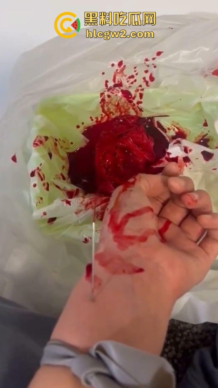 血腥慎入！推特十级脑残血腥自残自拍 残暴割腕引血自流 这是作死还是变态？-6