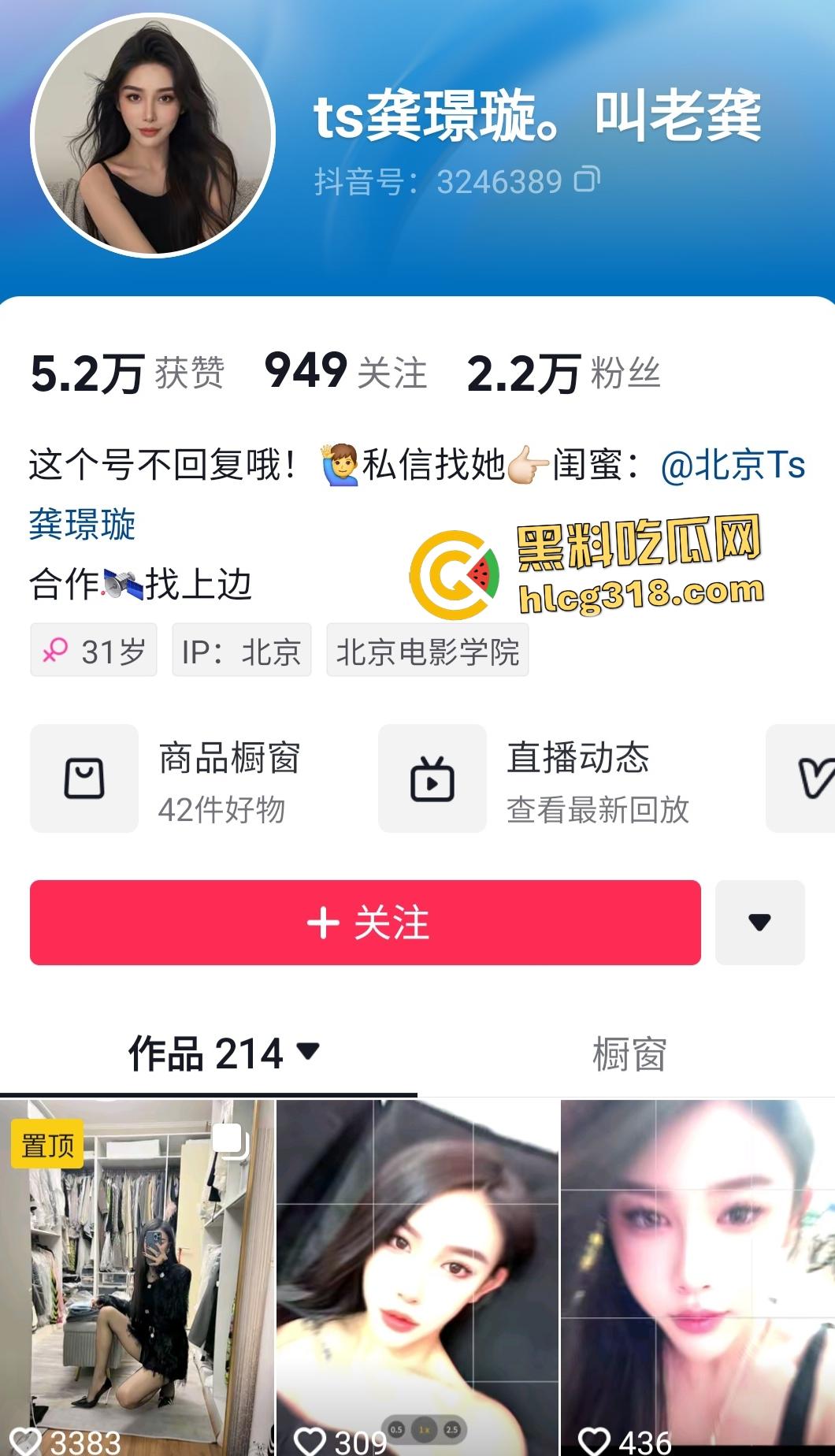 抖音【龚璟璇】人妖绿茶婊翻车！黑丝口交被秃顶金主内射，鸡鸡对鸡鸡比人体蜈蚣还骚！