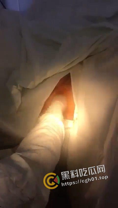 逆天！肛门掏出遥控器 这一定是不小心进去的吧  现场视频流出