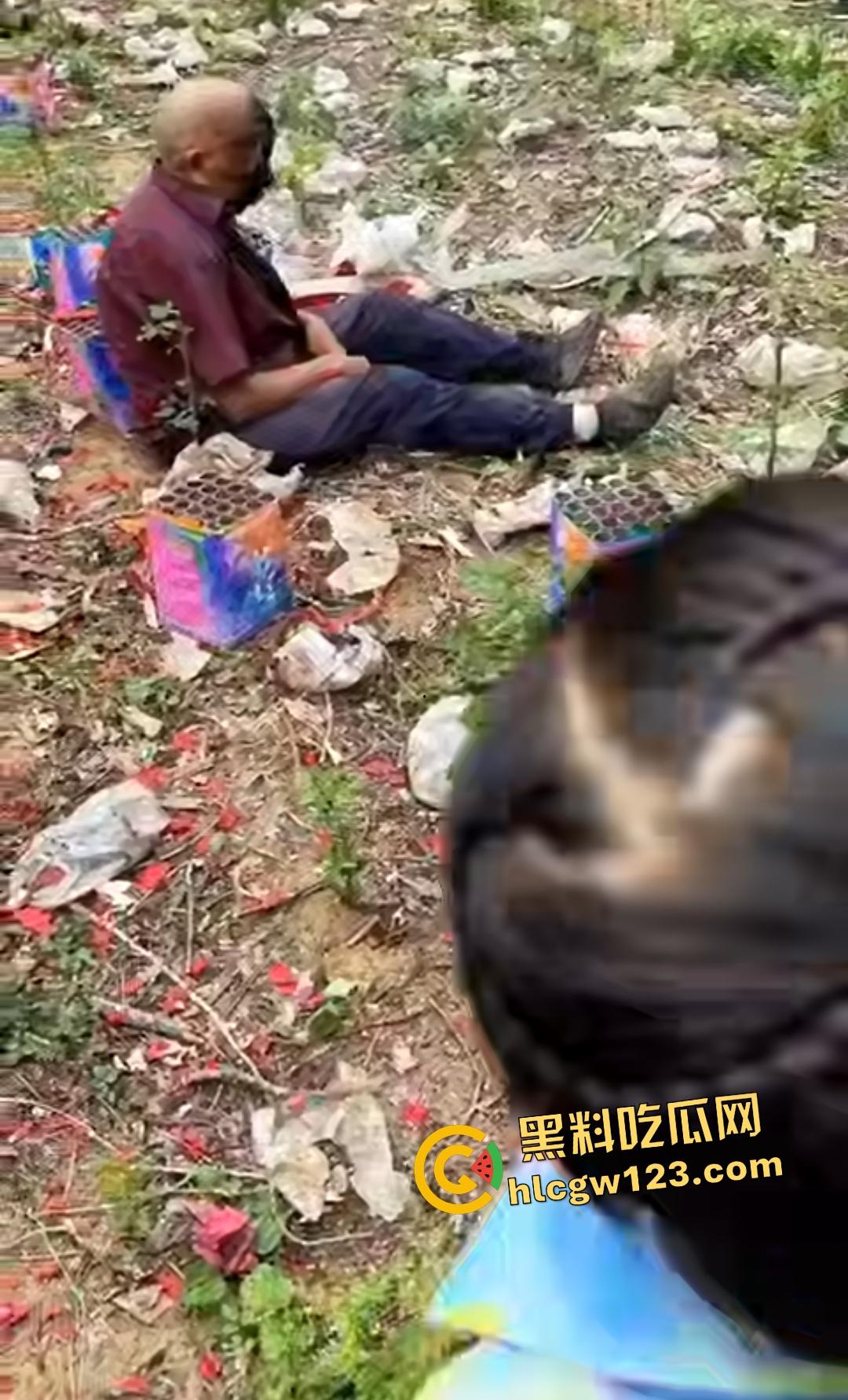 河南平顶山鲁山王大爷捡烟花炸头变黑鬼!右眼已瞎保不住,脑子里有骨头渣!-3