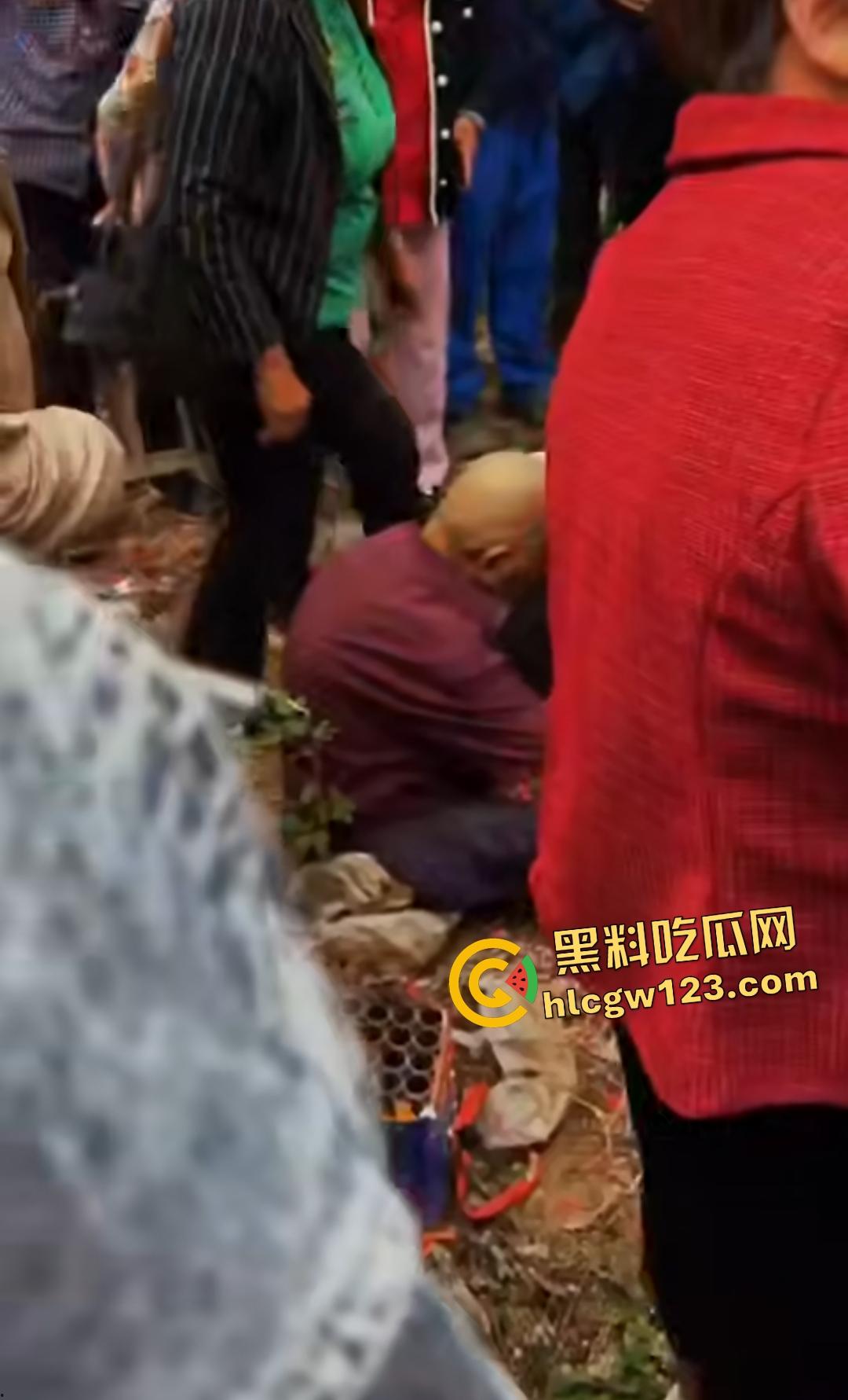 河南平顶山鲁山王大爷捡烟花炸头变黑鬼!右眼已瞎保不住,脑子里有骨头渣!-4