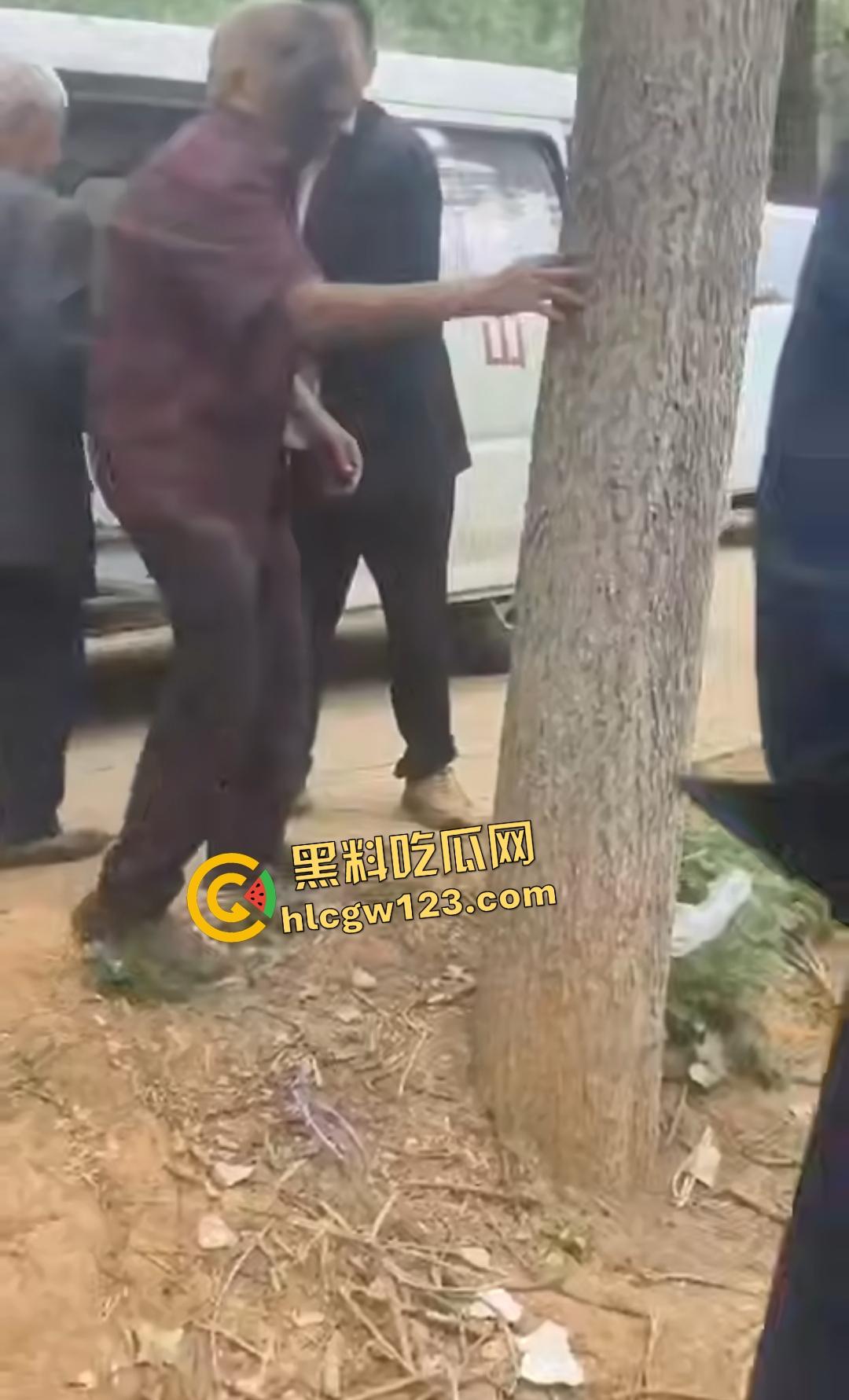 河南平顶山鲁山王大爷捡烟花炸头变黑鬼!右眼已瞎保不住,脑子里有骨头渣!-6