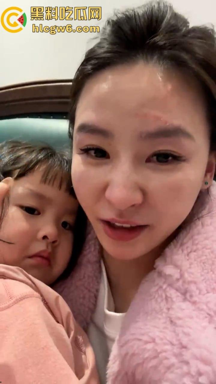 湖北一小学美女老师抖音自曝离婚探女遭前夫爹殴打抓脸全身多处受伤 伤情实拍曝光!都是血口子-3