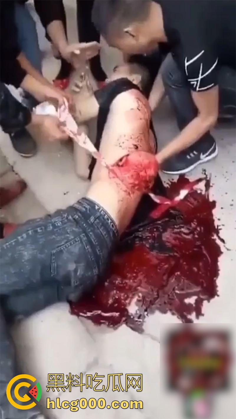 暗网流出恐怖一幕合集,小伙被砍透背部,东南亚混战分尸现场,树林剁头女孩被霸凌跳楼,胆小者勿入啊!-1