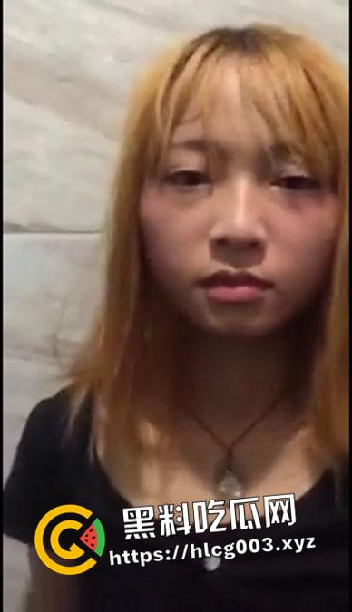 精神小妹酸奶倒进逼里 不自慰就被打 脸和逼都被打肿了 现场视频流出-1