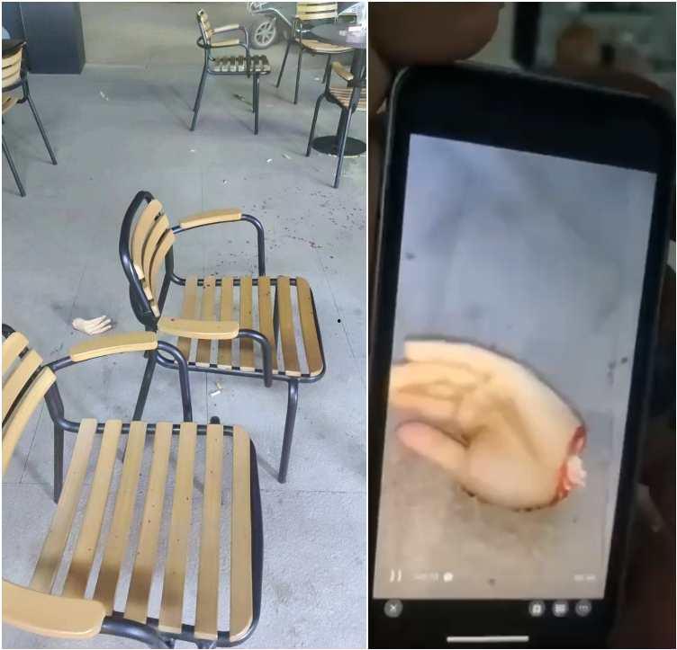 5月23号 厦门华天涉外职业技术学院 直播主 直播中遭刀仔持刀猛砍  左手掌被砍断 现场十分惊悚-7