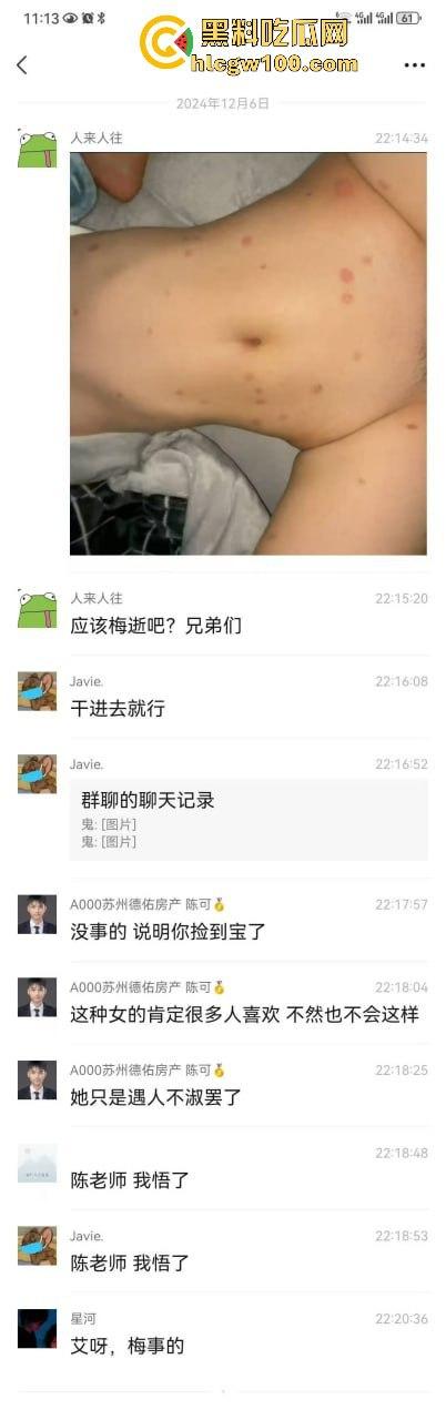 河南信阳啤酒森林酒吧惊现病毒母体!毒王身体浑身溃烂吓退众人,最近国内真的特别多各位瓜友一定要注意。-10