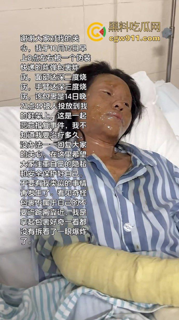 湖南性感擦边主播遭疯狂粉丝寄炸弹包裹炸伤,粉丝疯狂起来真恐怖啊,好端端的性感主播炸成了隔壁大妈!-9