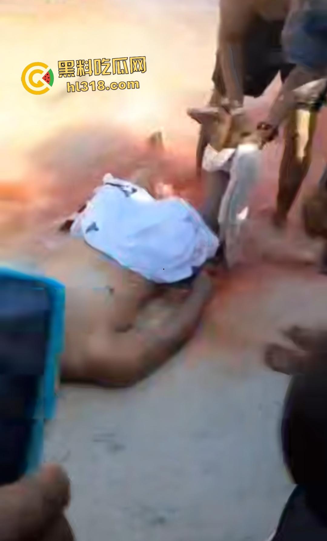 黑人男子海边遭螺旋桨血腥绞杀!下半身肉烂血染红海,旁人妄图复原断肢,谁知身体差点变两半!-8