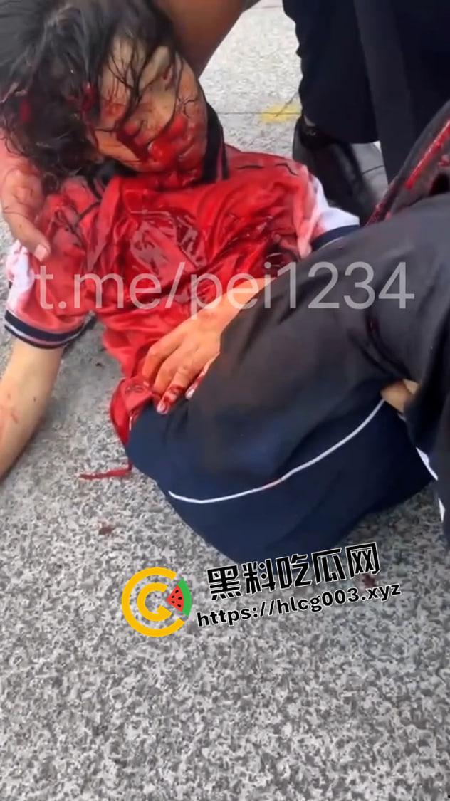大瓜速递!江西贵溪特大伤人案现场视频流出 暴徒闯进校园狂杀老师和学生 血腥慎入-3
