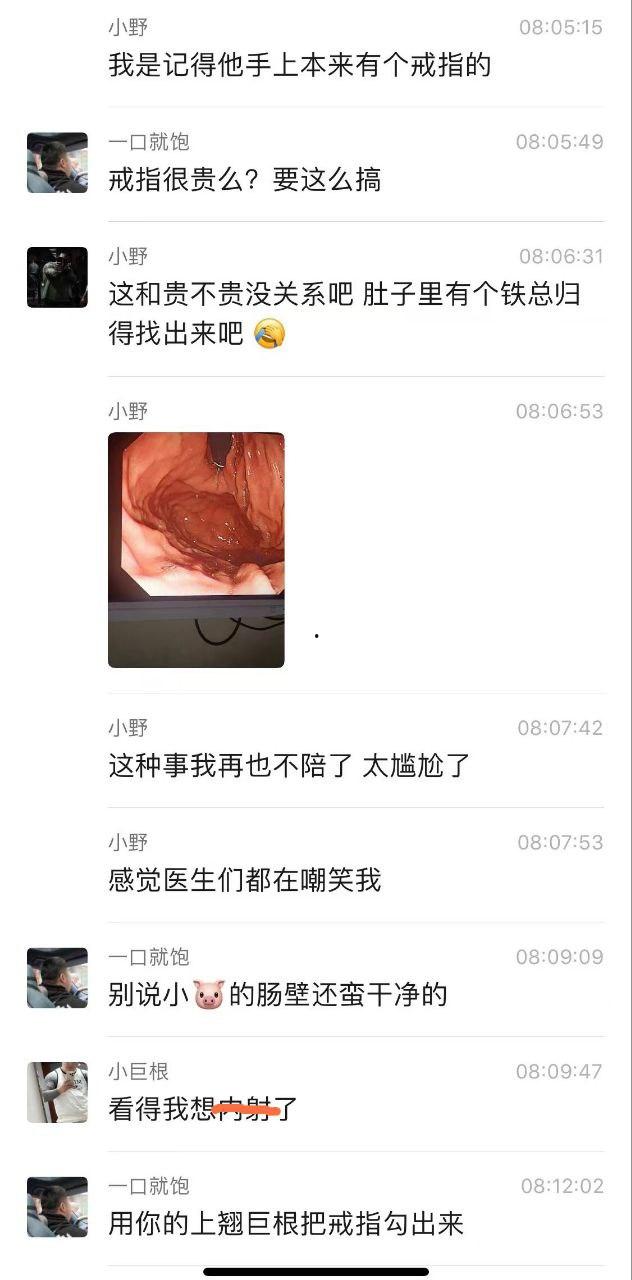 金主酒吧消费巨款,陪酒女为博金主一笑,酒后拳交,玩大了,金主爸爸手上戒指卡里面!-4