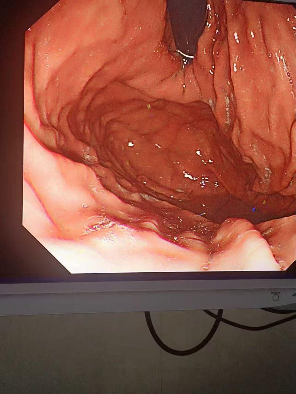 金主酒吧消费巨款,陪酒女为博金主一笑,酒后拳交,玩大了,金主爸爸手上戒指卡里面!-7