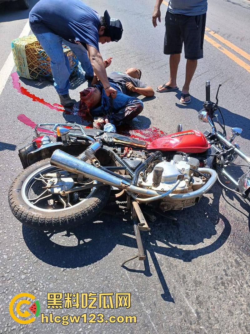 血腥恐怖交通事故,圣克鲁斯男骑手出车祸,左腿被当场撞断,现场视频流出胆小者勿入!-1
