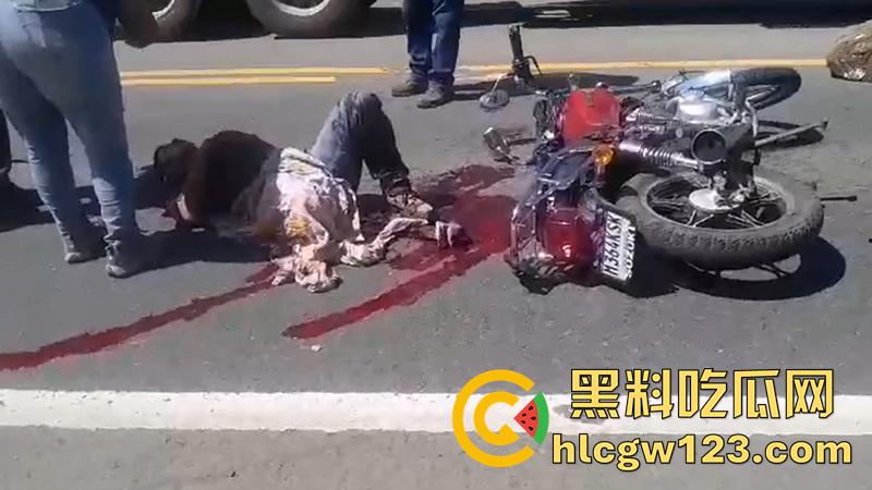血腥恐怖交通事故,圣克鲁斯男骑手出车祸,左腿被当场撞断,现场视频流出胆小者勿入!-2