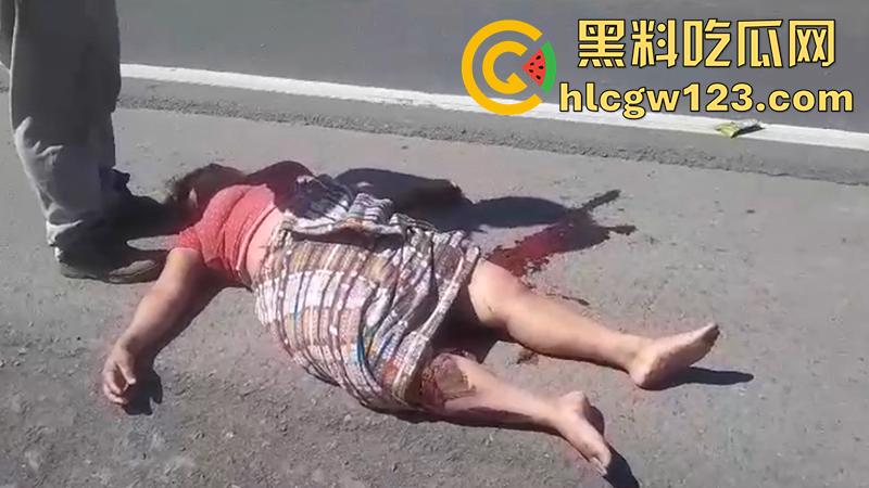 血腥恐怖交通事故,圣克鲁斯男骑手出车祸,左腿被当场撞断,现场视频流出胆小者勿入!-3