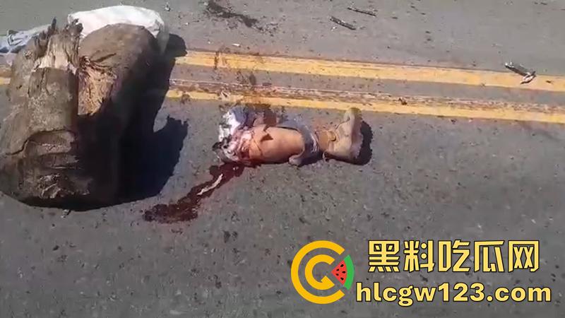 血腥恐怖交通事故,圣克鲁斯男骑手出车祸,左腿被当场撞断,现场视频流出胆小者勿入!-4