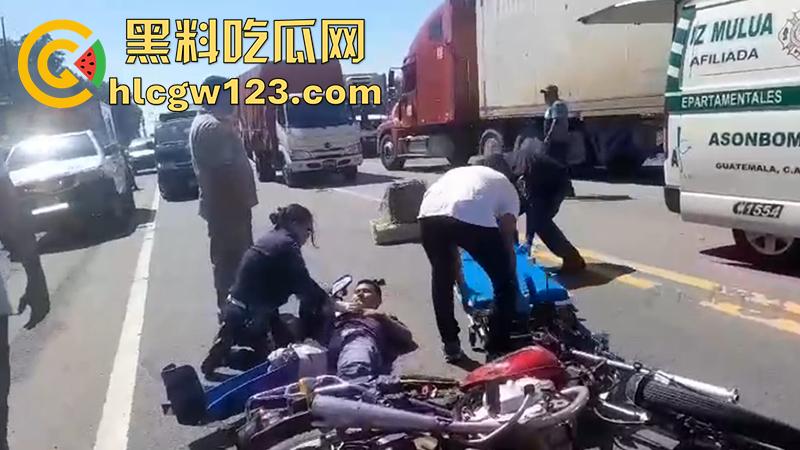 血腥恐怖交通事故,圣克鲁斯男骑手出车祸,左腿被当场撞断,现场视频流出胆小者勿入!-5