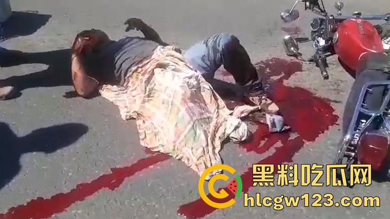 血腥恐怖交通事故,圣克鲁斯男骑手出车祸,左腿被当场撞断,现场视频流出胆小者勿入!-7