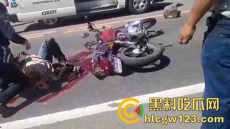 血腥恐怖交通事故,圣克鲁斯男骑手出车祸,左腿被当场撞断,现场视频流出胆小者勿入!-8