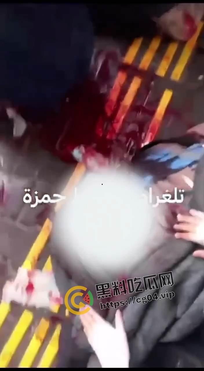 现场画面!血流成河 以色列轰炸加沙南部驻留有大量难民的学校 造成大量伤亡 尸体堆积如山 遍地鲜血-1
